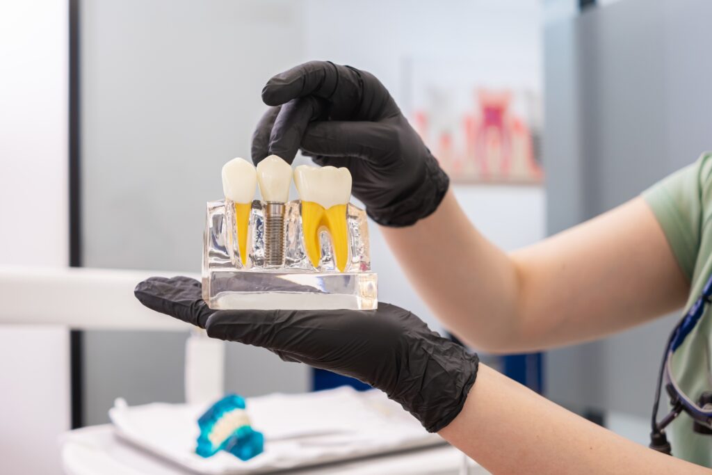 Dental professional holding a model of dental implants