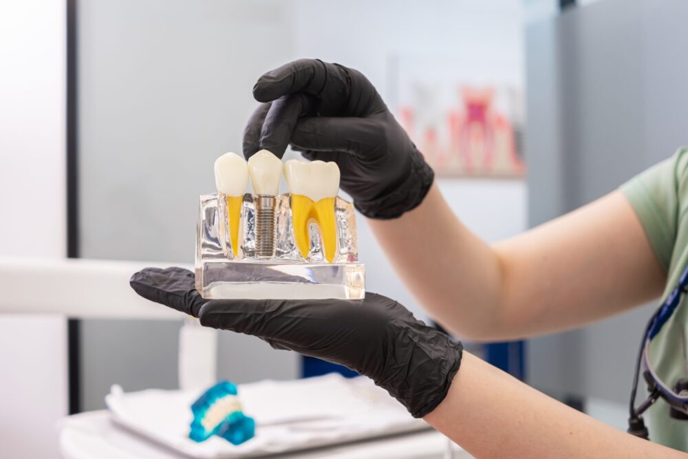 Dental professional holding a model of dental implants